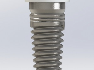 Dental implant 3D 模型
