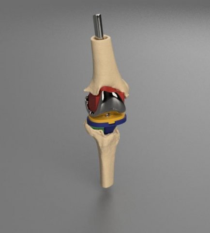 Total-knee-replacement-project 3D Model .c4d .max .obj .3ds .fbx .stl .blend 