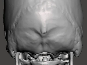 Brain-in-skull-with-neck 3D Model