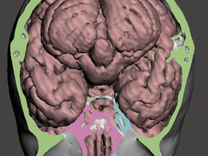 Brain-in-skull-with-neck 3D Model