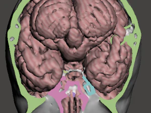 Brain-in-skull-with-neck 3D Model
