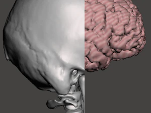 Brain-in-skull-with-neck 3D Model