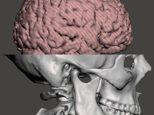 Brain-in-skull-with-neck 3D Model