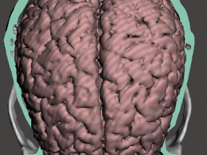Brain-in-skull-with-neck 3D Model