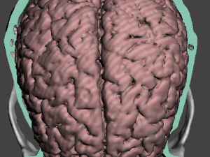 Brain-in-skull-with-neck 3D Model