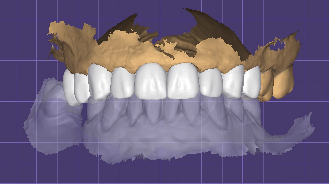 Crown-9 teeth 3D Model .c4d .max .obj .3ds .fbx .stl .blend