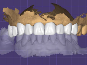Crown-9 teeth 3D Model