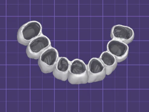 Crown-9 teeth 3D Model