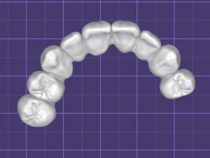 Crown-9 teeth 3D Model