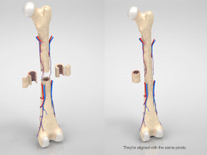 Bone with Healthy and Osteoporotic Section Modelo 3D