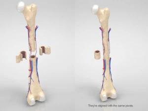 Bone with Healthy and Osteoporotic Section 3D Model