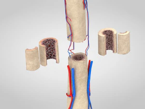 Bone with Healthy and Osteoporotic Section 3D Model