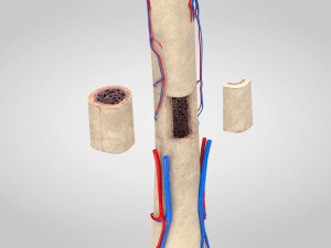 Bone with Healthy and Osteoporotic Section Modelo 3D