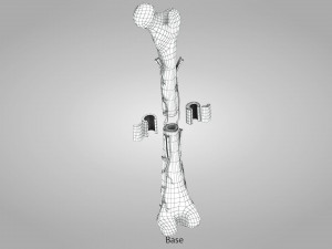 Bone with Healthy and Osteoporotic Section Modelo 3D