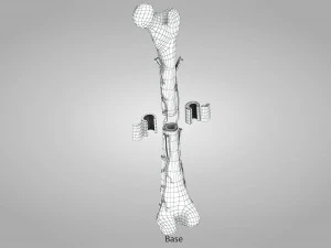 Bone with Healthy and Osteoporotic Section 3D Model