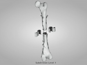 Bone with Healthy and Osteoporotic Section Modelo 3D