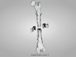 Bone with Healthy and Osteoporotic Section 3D Model