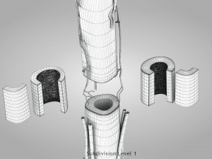 Bone with Healthy and Osteoporotic Section Modelo 3D