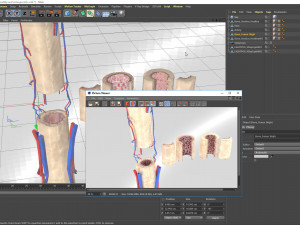Bone with Healthy and Osteoporotic Section Modelo 3D