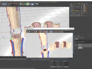 Bone with Healthy and Osteoporotic Section 3D Model