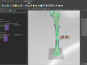 Bone with Healthy and Osteoporotic Section Modelo 3D