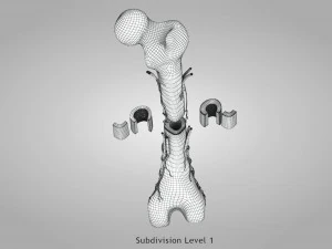 Bone with Healthy and Osteoporotic Section 3D Model