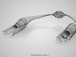 Blood Vessels 3D Model