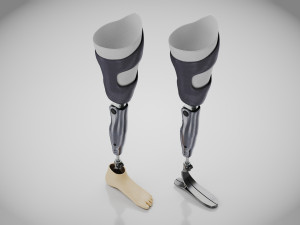 Above Knee Leg Prosthetics - Implant Modelo 3D