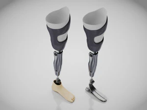 Pr&oacute;teses Acima do Joelho - Implante Modelo 3D
