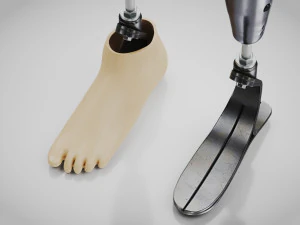Pr&oacute;teses Acima do Joelho - Implante Modelo 3D