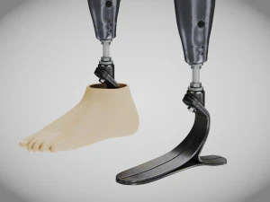 Pr&oacute;teses Acima do Joelho - Implante Modelo 3D