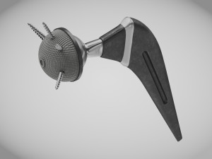 Hip Implant Low-poly Modello 3D