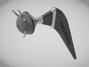 H&uuml;ftimplantat Low-Poly 3D Modell