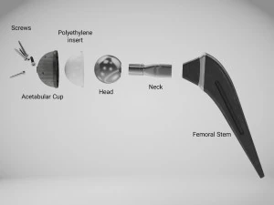 Hip Implant Low-poly 3D Model