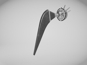 Hip Implant Low-poly 3D Model