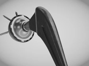 Hip Implant Low-poly 3D Model