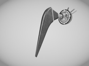 Hip Implant Low-poly 3D Model