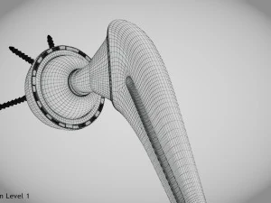 Hip Implant Low-poly 3D Model