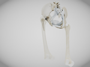 Replaced Hip Implant Modelo 3D