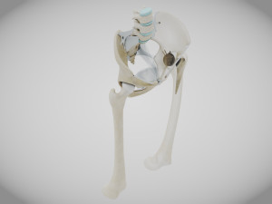 Replaced Hip Implant Modelo 3D