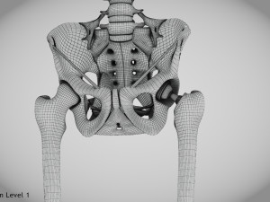 Replaced Hip Implant Modelo 3D