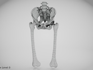 Replaced Hip Implant Modelo 3D