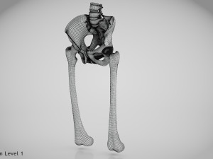 Replaced Hip Implant Modelo 3D