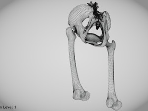 Replaced Hip Implant Modelo 3D