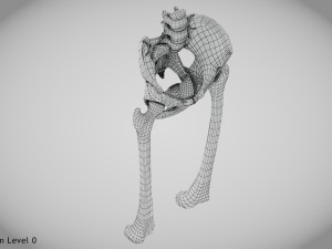 Replaced Hip Implant Modelo 3D