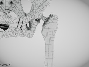 Replaced Hip Implant Modelo 3D