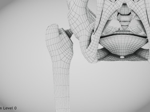 Replaced Hip Implant Modelo 3D