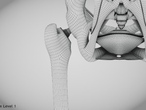 Replaced Hip Implant Modelo 3D