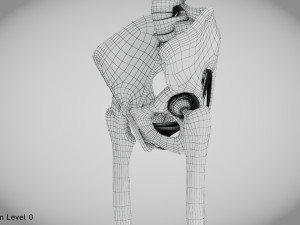 Replaced Hip Implant Modelo 3D