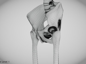 Replaced Hip Implant Modelo 3D